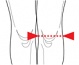 Ortza kolennho kloubu  krtk lebn s dvouosm kloubem, rozepnac OR 7C/r (SKL:04-5005842) (foto 1)