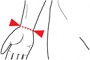 Obvod zpst - Ortza palce s dlahou  OR 10A (SKL:04-5005846) (foto 1)