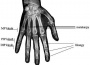 Ortza prstu - prstov dlaha - typ 309 s fixac (SKL:04-5001875) (foto 5)